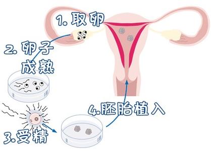 光愈生殖医学中心